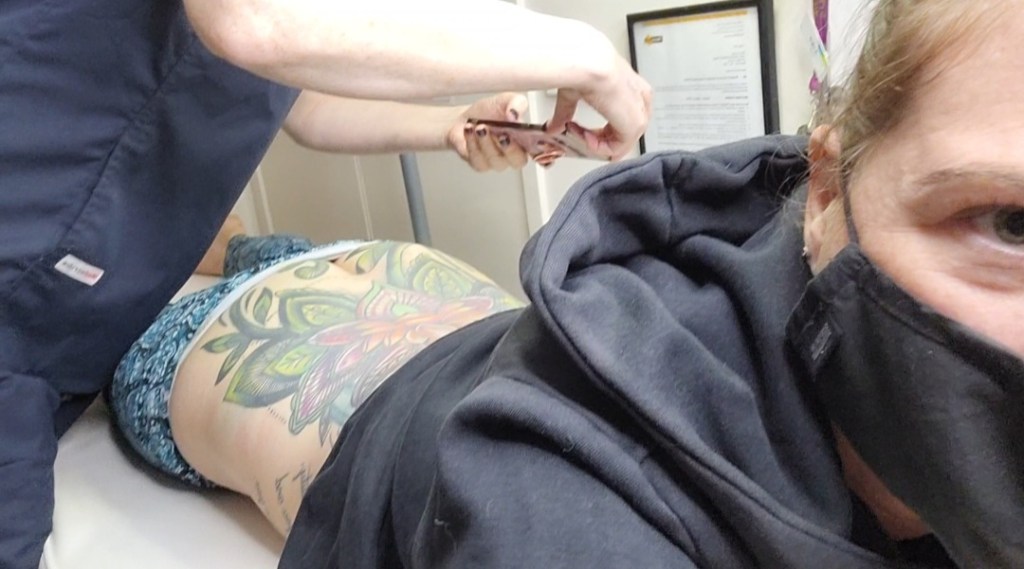 Day 98: 6th April 2022 | Part 4 | Tattoo Lazar Removal&nbsp;No.1