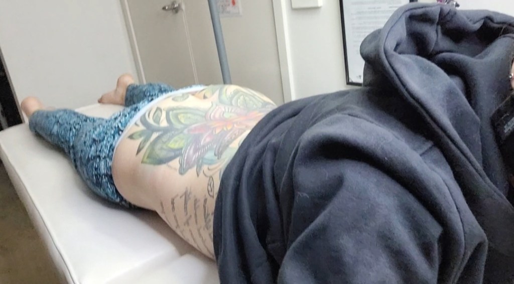 Day 98: 6th April 2022 | Part 5 | Tattoo Lazer Removal&nbsp;No.2