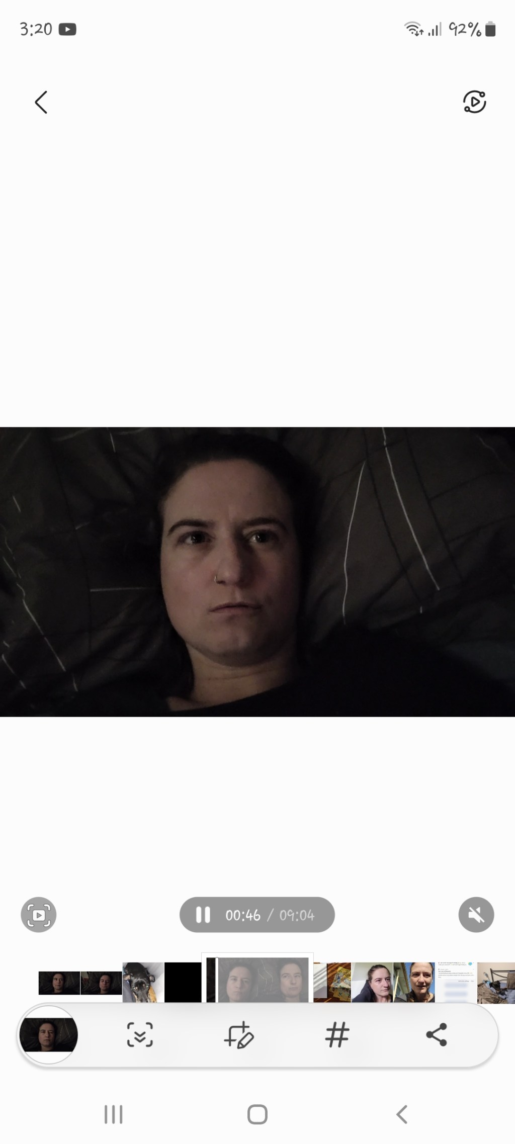 Day 145: 23rd May 2022 | Part 3 | Sedated and cuddling with Boss&nbsp;😳