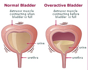 I hate my bladder!!&nbsp;😔😫