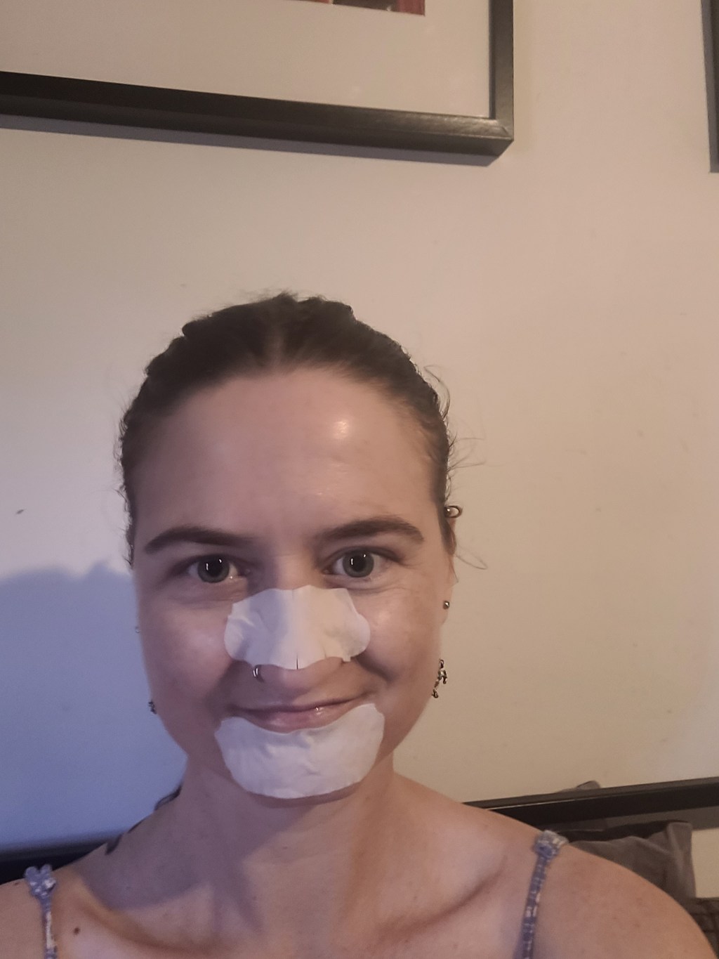 The whitehead pimple on my chin won’t go away&nbsp;😖😅